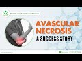 Avascular necrosis avn treatment testimonial stemrx mumbai success story