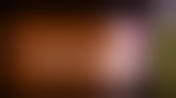 Malar or cheek implants are done to improve facial esthetics - better effect than facelift!!