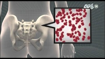 VTC14_Mỹ thử nghiệm loại thuốc chữa ung thư máu mới