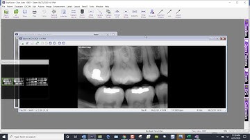 Training Video - XrayVision: Changing the View With Multiple Dates Selected