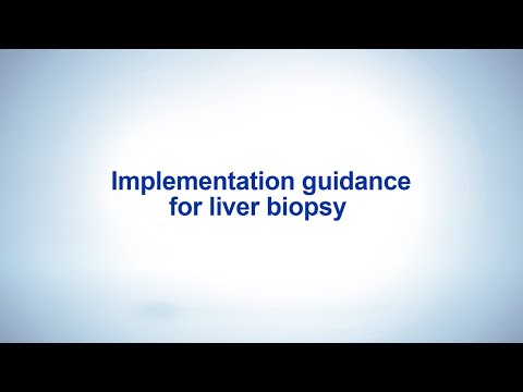 Implementation guidance for liver biopsy