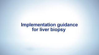 Implementation guidance for liver biopsy