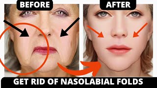 Amazing Face Massage That ERASES Laugh Lines & Nasolabial Folds FAST