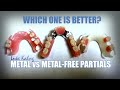 Metal vs Metal Free Partials: Which is Best?