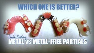 Metal vs Metal Free Partials: Which is Best?