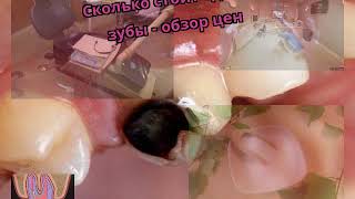 Сколько стоит сделать зубы - обзор цен Сколько стоит сделать зубы - обзор цен