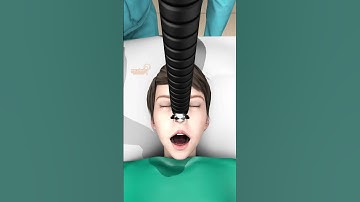 Học và Hỏi - Việc bị một con rắn chui vào miệng là trải nghiệm như thế nào?  #xuhuong #kienthucthuvi