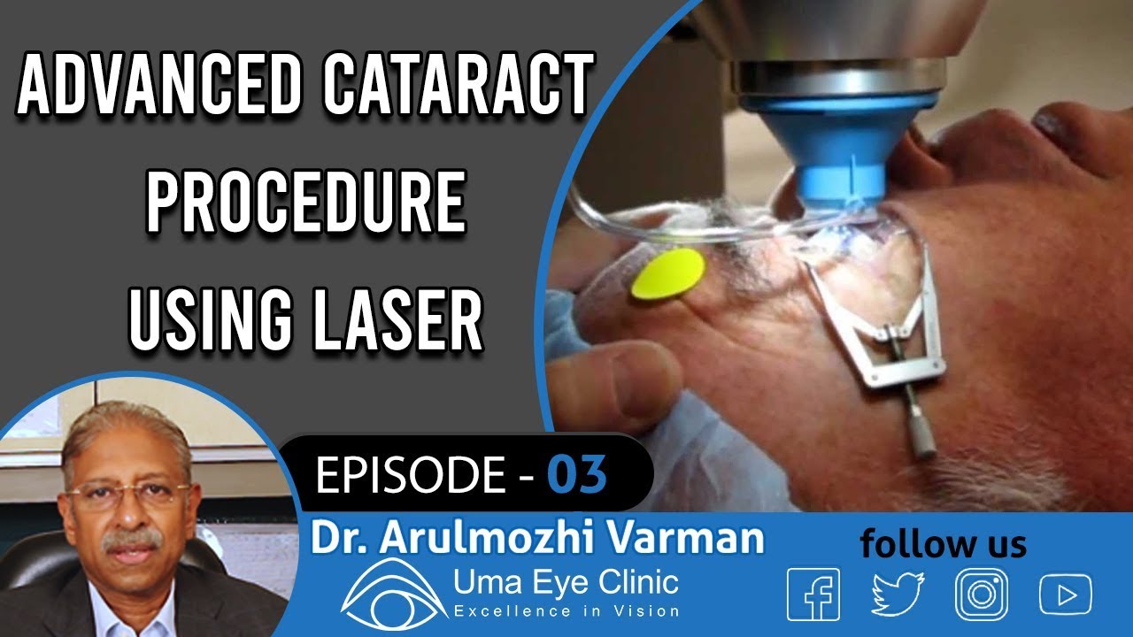 Advanced cataract procedure using laser catalys Uma Eye Clinic, Anna