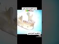 Dentist Dentistry اسنان بغداد ترند مجتمع Orthodontic تقويم جراحي Orthognathic 