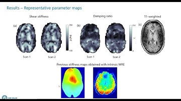 Estimating the viscoelastic properties of the brain using intrinsic MRE at 7T
