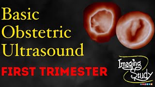 Basic Obstetric Ultrasound: First Trimester Pregnancy screenshot 4