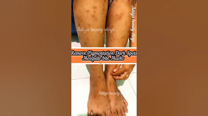 How To Get Rid Of Dark Spots Scar, Mosquito Bites Pigmentation #darkspots #skincare#viral