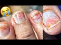 UÑAS QUE DAN GANAS DE LLORAR😭 | COMO ARREGLARLO?| TRABAJO CON ACRIGEL