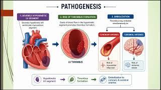 One Patient, Two Catastrophes: Managing Stroke and MI at the same Time