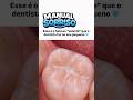 Assim que é feito o Selante no dente do seu filho! #information #SaúdeBucal #Odontologia #dentista