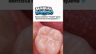 Assim que é feito o Selante no dente do seu filho! #information #SaúdeBucal #Odontologia #dentista