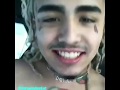 Lil pump gets his braces off