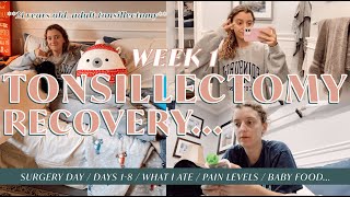 ADULT TONSILLECTOMY | SURGERY DAY, RECOVERY DAYS 18, what I ate, pain levels, & more! *unfiltered*