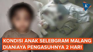 Anak Aghnia Punjabi Dianiaya Pengasuh, Korban Alami Kekerasan Usai Dititipkan 2 Hari