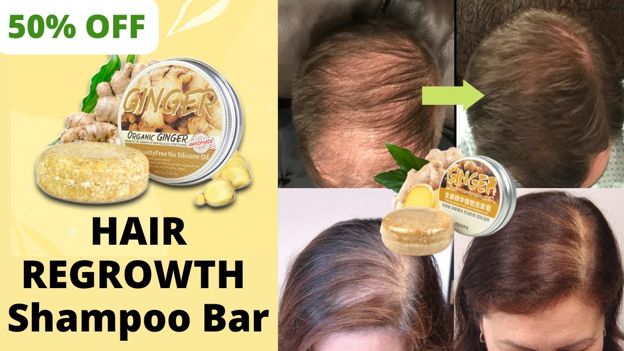 Ginger Hair Regrowth Shampoo Bar YouTube