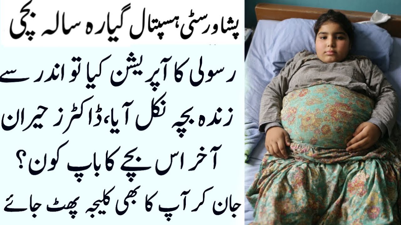 cyst Operation | Zinda Bacha Nikla | Doctors Hairan | Sachi Islami Kahani