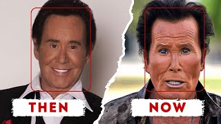 SHOCKING Male Plastic Surgery Transformations! | Then and Now 2025