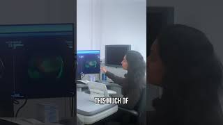 Optimap Revolution See Your Retina Like Never Before