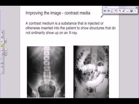 A level Medical Physics - X rays - image intensifiers and contrast