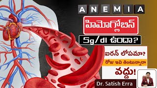 Anemia Symptoms and Treatment | Iron Deficiency | Dr.Satish Erra Homeopathy