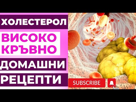 Видео: Как да предотвратим образуването на кръвни съсиреци (със снимки)