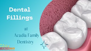 Dental fillings at Acadia Family Dentistry explained by Dr. Nhu Le