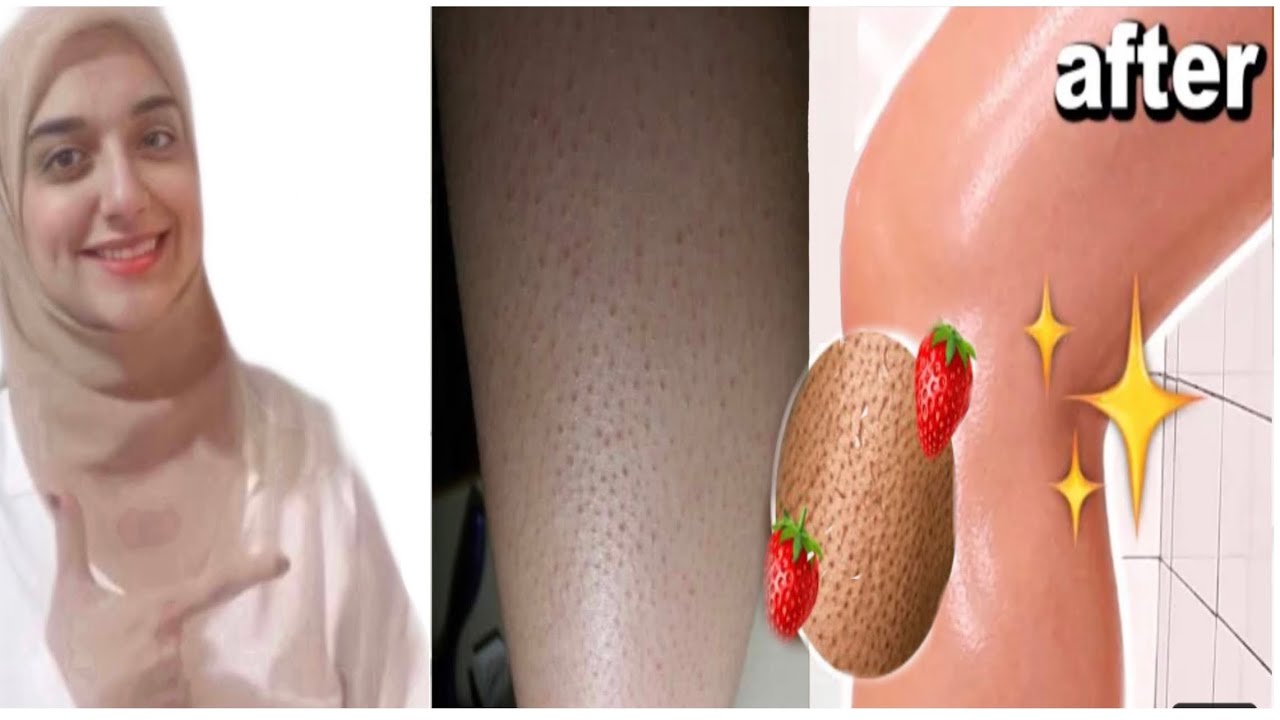 اسرع طريقة للتخلص من جلد الوزةفي ٣ أيام فقط/من جلد خشن ومحبب لجلد ناعم ولامع / مجرب باقل من ٥٠ جنيه