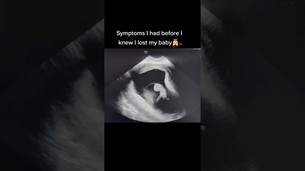 THEN NO HEARTBEAT AT 9 WEEK SCAN😊