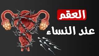 أعراض العقم عند النساء و أسبابه