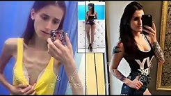 Sering di ejek karna kurus, wanita ini membuat publik tercengan karna perubahanya - Durasi: 2.24. 