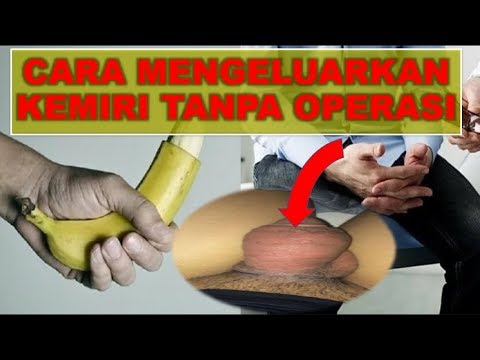 obat-penis-membengkak-&-kulitnya-mengeras-karena-suntik-kemiri-/-silikon---tanpa-operasi