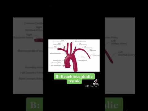 Anatomy hack: Memorise