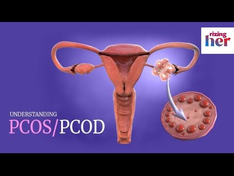 What is Polycystic Ovary Syndrome (PCOS) | menstruation and Polycystic Ovary Syndrome | Causes.
