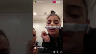 Dixie D’Amelio’s ig live. After nose surgery with Heidi | September 16