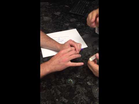 PIP Joint Dislocations with Dr. Fakhouri