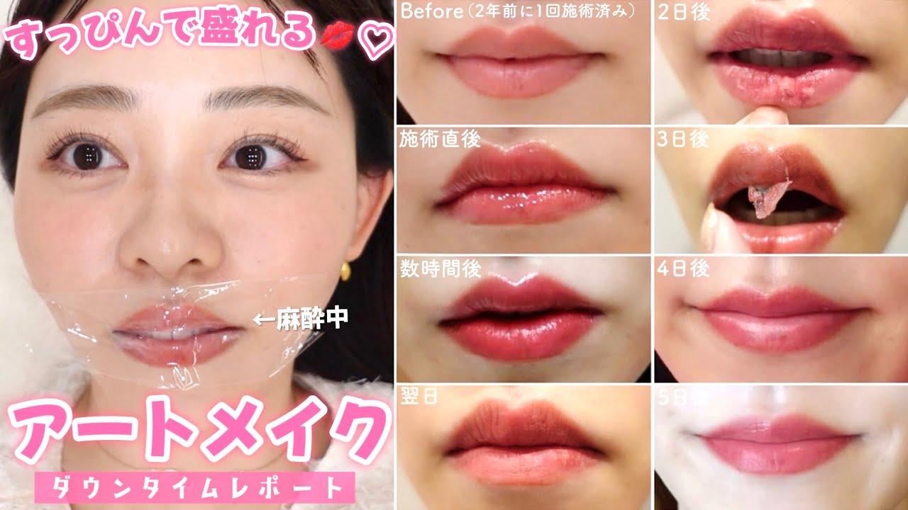 当時のメディア報道・掲載写真