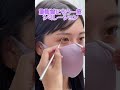 【二重整形】✨You Tuberかっぱちゃん二重埋没しました✨#shorts