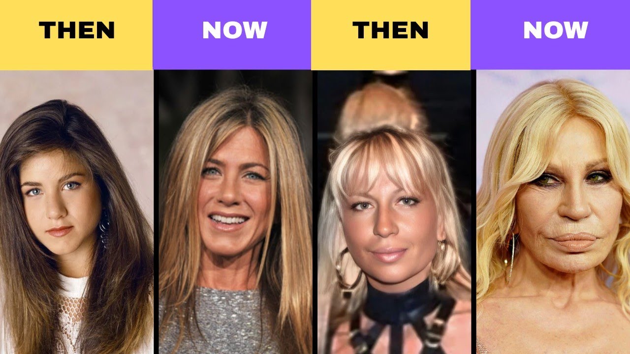 Unbelievable Celebrity Transformations  | Before vs Now