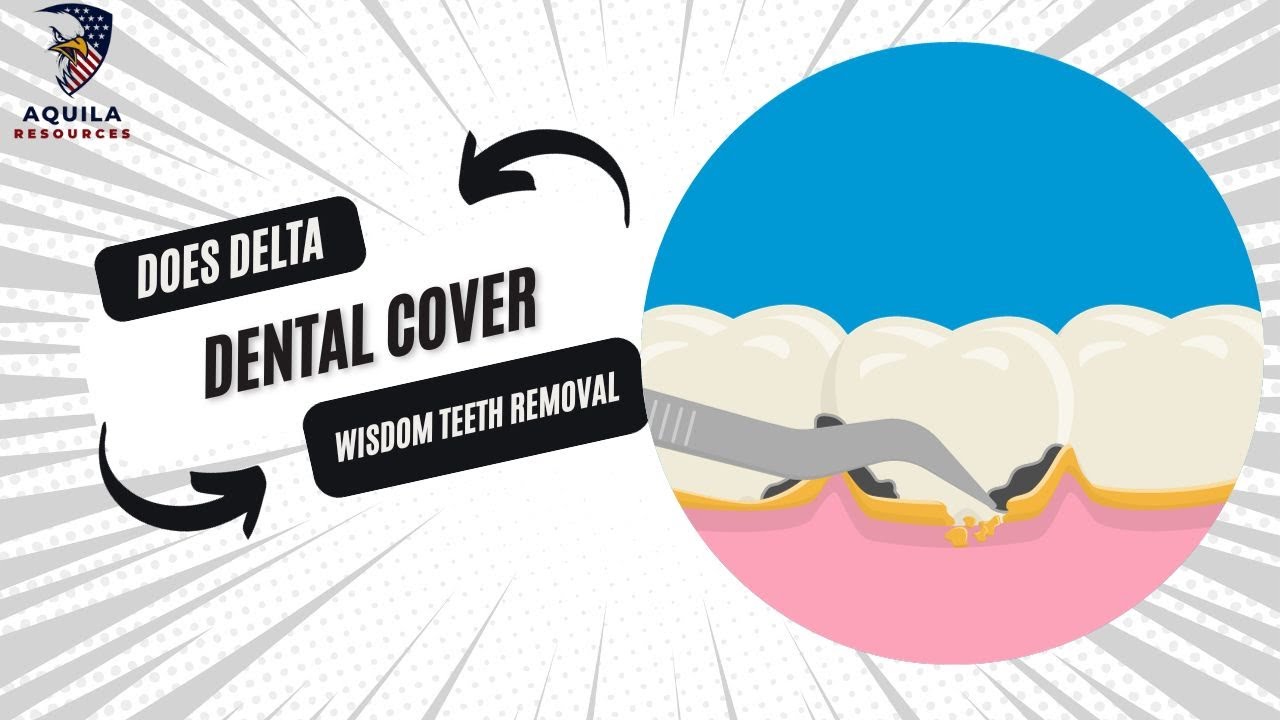 does-delta-dental-cover-wisdom-teeth-removal-wisdomtooth-delta