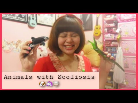 What Skoliosis Idiopatik