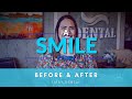 Fix Your Smile with Libby Dental - TMJ - Carolina
