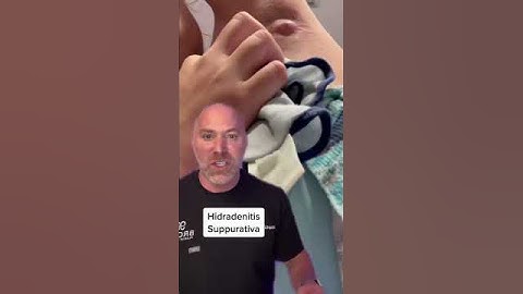 Shocking Armpit Pimple Explained 😱 #shorts