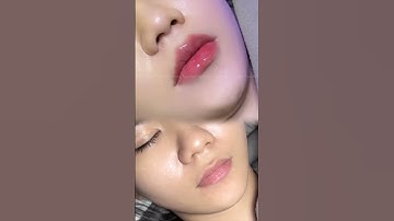Xem hết 5s để thấy sự biến đổi đáng kinh ngạc #beforeandafter  #xuhuongyoutube #tiemmoi #fillerlips