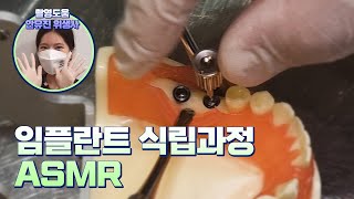 [Seoul Dental] Dental Implant Procedure