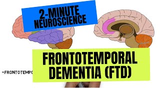 2-Minute Neuroscience: Frontotemporal Dementia (FTD) by Neuroscientifically Challenged 26,978 views 1 year ago 2 minutes